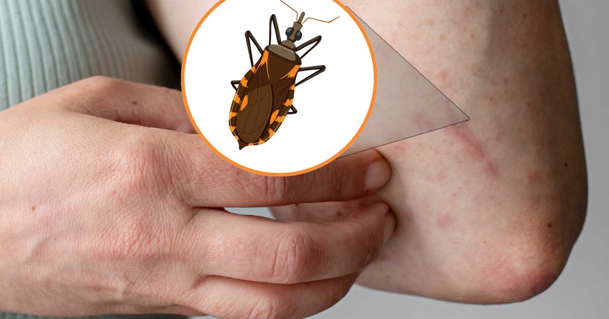 Chagas, una enfermedad que azota sin tregua