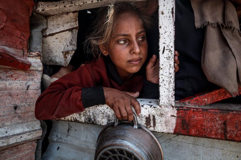 El impacto de la hambruna en Gaza, una muerte dolorosa hoy y una condena para las generaciones venideras: “Los niños comen hojas” | Salud y bienestar