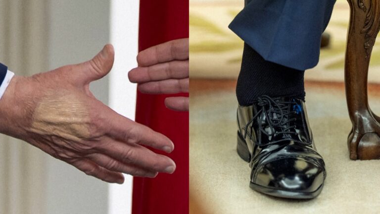 Los problemas de salud de Trump y las explicaciones de la Casa Blanca disparan los rumores