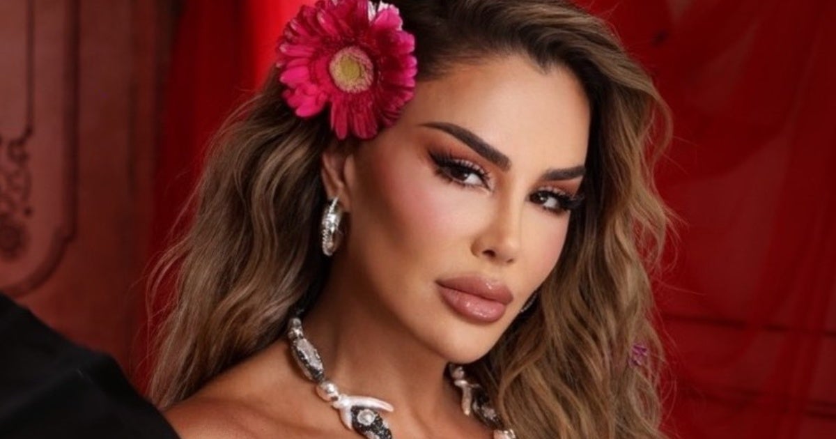 Ninel Conde fue operada antes de entrar a La Casa de los Famosos 2025; ¿qué le pasó?