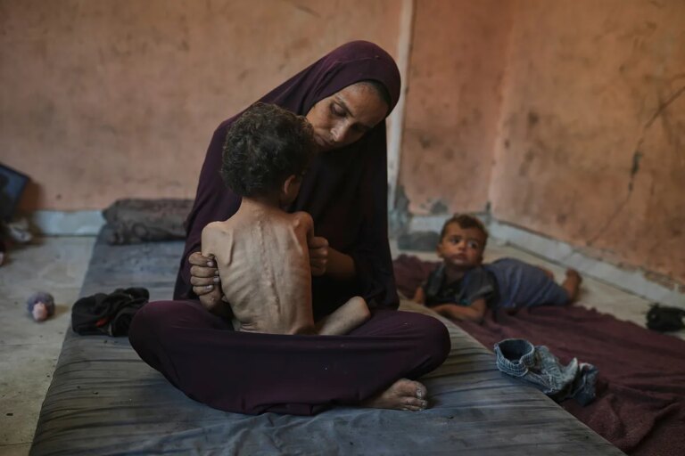 Aumentan a 100 los niños muertos por desnutrición en Gaza desde el inicio de la ofensiva israelí