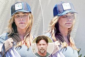 Captan a Denise Richards con moretón en el ojo y heridas