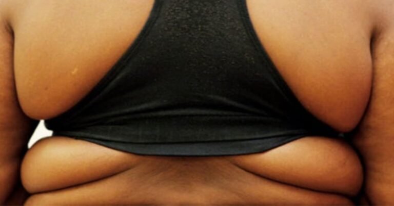 El análisis genético en la infancia predice el riesgo de obesidad en la adultez