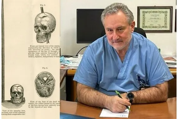Un italiano sobrevive dos días en su casa con una flecha clavada en la cabeza